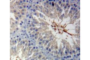 Used in DAB staining on fromalin fixed paraffin-embedded testis tissue (Calmodulin 1 Antikörper  (AA 1-149))
