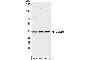 Western Blotting (WB) image for anti-Glyoxalase Domain Containing 4 (GLOD4) (AA 100-150) antibody (ABIN7449229)