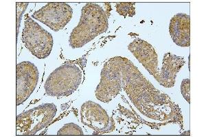 IHC analysis of BubR1/BUB1B using anti-BubR1/BUB1B antibody (ABIN7600962). (BUB1B Antikörper  (AA 26-448))