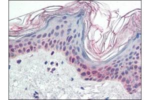 Human Skin (formalin-fixed, paraffin-embedded) stained with PARP2at 2. (PARP2 Antikörper  (Internal Region))