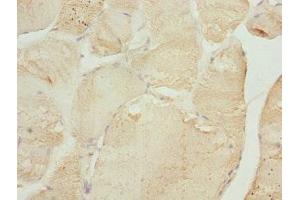 Immunohistochemistry of paraffin-embedded human skeletal muscle tissue using ABIN7173581 at dilution of 1:100 (TNNI2 Antikörper  (AA 1-100))