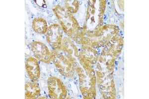 Immunohistochemistry of paraffin-embedded mouse kidney using  antibody (ABIN7265428) at dilution of 1:100 (40x lens). (ACOT2 Antikörper  (AA 222-483))