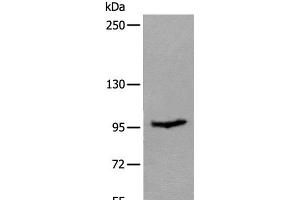Western blot analysis of Mouse skeletal muscle tissue lysate using UNC45B Polyclonal Antibody at dilution of 1:600 (UNC45B Antikörper)