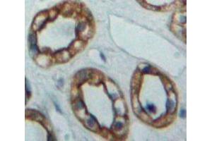 Used in DAB staining on fromalin fixed paraffin-embedded Kidney tissue (ADCY5 Antikörper  (AA 167-385))