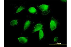 Immunofluorescence of purified MaxPab antibody to F2 on HepG2 cell. (Prothrombin Antikörper  (AA 1-622))