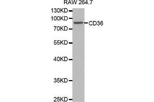 Western blot analysis of extracts of RAW264. (CD36 Antikörper  (AA 301-400))