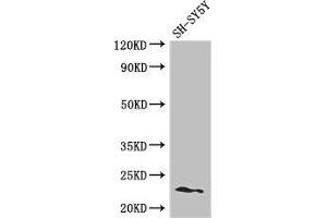 Western Blot Positive WB detected in: SH-SY5Y whole cell lysate All lanes: PEMT antibody at 2. (PEMT Antikörper  (AA 2-49))