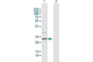 Western Blot analysis of C7orf30 expression in transfected 293T cell line by C7orf30 MaxPab polyclonal antibody. (C7orf30 Antikörper  (AA 1-234))