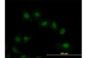 Immunofluorescence of monoclonal antibody to VRK2 on HeLa cell.