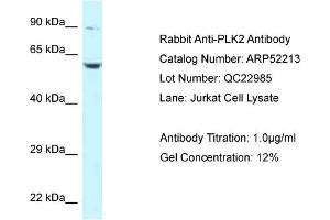 Western Blotting (WB) image for anti-Polo-Like Kinase 2 (PLK2) (Middle Region) antibody (ABIN2784827)