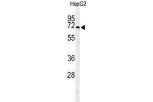 Western blot analysis of ARSI Antibody (C-term) in HepG2 cell line lysates (35µg/lane). (Arylsulfatase I Antikörper  (C-Term))