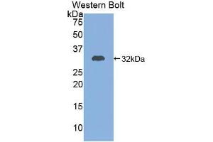 Western blot analysis of the recombinant protein. (ADCY7 Antikörper  (AA 806-1052))