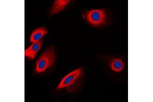 Immunofluorescent analysis of POFUT1 staining in K562 cells.