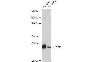Western blot analysis of extracts of various cell lines, using FGF21 Rabbit mAb (ABIN1680154, ABIN3018263, ABIN3018264 and ABIN7101589) at 1:1000 dilution. (FGF21 Antikörper)