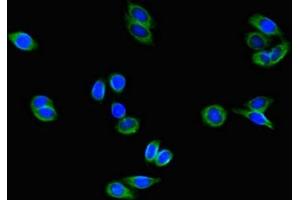Immunofluorescence (IF) image for anti-Copper Metabolism (Murr1) Domain Containing 1 (COMMD1) (AA 2-190) antibody (ABIN7148300)