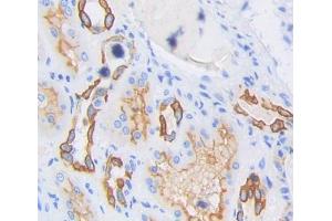 Used in DAB staining on fromalin fixed paraffin- embedded Kidney tissue (TBXAS1 Antikörper  (AA 357-533))