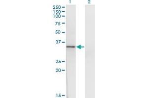 Western Blot analysis of HOXD1 expression in transfected 293T cell line by HOXD1 monoclonal antibody (M01), clone 4F4. (HOXD1 Antikörper  (AA 151-240))