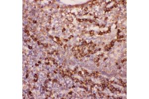 Anti-CD11b Picoband antibody ,  IHC(P): Human Tonsil Tissue (CD11b Antikörper  (AA 17-382))
