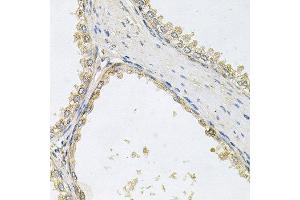 Immunohistochemistry of paraffin-embedded human prostate using POMGNT1 antibody at dilution of 1:100 (x40 lens). (POMGNT1 Antikörper)
