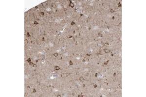 Immunohistochemical staining of human cerebral cortex with GTPBP8 polyclonal antibody  shows strong cytoplasmic positivity in neuronal cells. (GTPBP8 Antikörper)