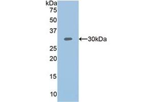 Western blot analysis of recombinant Human PLS3. (Plastin 3 Antikörper  (AA 379-630))