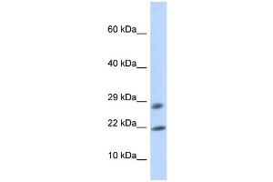 WB Suggested Anti-OCIAD2 Antibody Titration: 0.