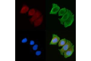 ABIN6263638 and ABIN6272363 staining Hela cells(30 min of UV treatment) by IF/ICC. (Nidogen Antikörper  (Internal Region))
