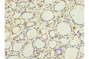 Immunohistochemistry of paraffin-embedded human thyroid tissue using ABIN7152056 at dilution of 1:100 (Ethanolamine Kinase 1 Antikörper  (AA 90-258))