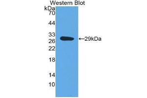 Western Blotting (WB) image for anti-Dopamine beta-Hydroxylase (Dopamine beta-Monooxygenase) (DBH) (AA 335-571) antibody (ABIN1858608) (DBH Antikörper  (AA 335-571))