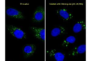 Immunofluorescent analysis of U251 cells, using LC3 Antibody.