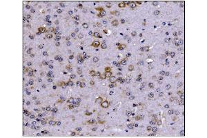 IHC analysis of SCN1B using anti-SCN1B antibody (ABIN7600600).