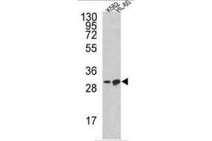 Western blot analysis of BCL2L11 Antibody (Center) in K562, HL-60 cell line lysates (35ug/lane). (BIM Antikörper  (Middle Region))