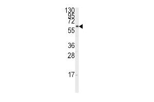 Western blot analysis of anti-CYP17A1 Antibody (Center) (ABIN392362 and ABIN2841999) in K562 cell line lysates (35 μg/lane). (CYP17A1 Antikörper  (AA 358-388))