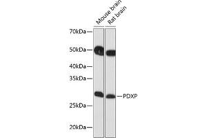 Western blot analysis of extracts of various cell lines, using PDXP Polyclonal Antibody (ABIN7269758) at 1:1000 dilution.