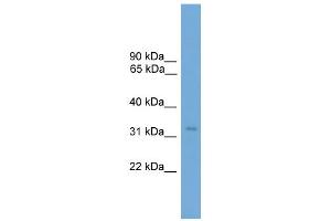 WB Suggested Anti-TCEA2 Antibody Titration: 0. (TCEA2 Antikörper  (N-Term))