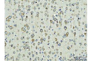 IHC analysis of Rpl9 using anti-Rpl9 antibody (ABIN7599060). (RPL9 Antikörper  (AA 1-192))