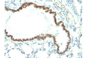 Formalin-fixed, paraffin-embedded Rat Lung stained with Ep-CAM Monoclonal Antibody (Epcam/1158). (EpCAM Antikörper)
