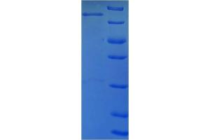 SDS-PAGE (SDS) image for Lymphocyte Cytosolic Protein 1 (LCP1) (AA 2-627) protein (His-SUMO Tag) (ABIN5709841)