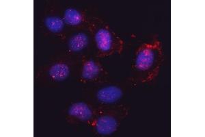 IF analysis of SEMA4F using anti-SEMA4F antibody (ABIN7601432).