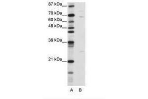 KLHL13 anticorps  (N-Term)