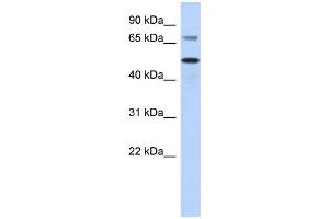 WB Suggested Anti-AKT2 Antibody Titration:  0. (AKT2 Antikörper  (Middle Region))