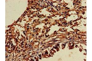 Immunohistochemistry of paraffin-embedded human lung tissue using ABIN7174052 at dilution of 1:100 (TYRO3 Antikörper  (AA 728-873))