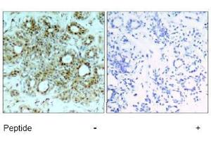 Image no. 1 for anti-Nuclear Factor-kB p65 (NFkBP65) (Ser311) antibody (ABIN197510)