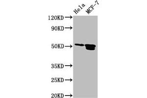 Western Blot Positive WB detected in: Hela whole cell lysate, MCF-7 whole cell lysate All lanes: TFAP2B antibody at 3. (TFAP2B Antikörper  (AA 111-208))
