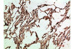 Immunohistochemical analysis of paraffin-embedded human-lung, antibody was diluted at 1:200 (ADI1 Antikörper  (AA 71-120))