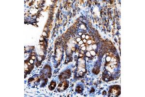 IHC analysis of Rab4/RAB4A using anti-Rab4/RAB4A antibody (ABIN7599733).