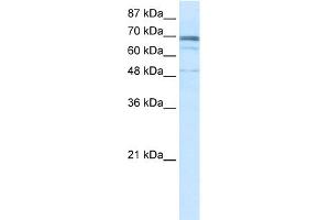 WB Suggested Anti-ZNF614 Antibody Titration:  0. (ZNF614 Antikörper  (N-Term))