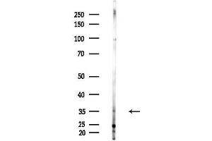 anti-Cytosolic Thiouridylase Subunit 1 Homolog (CTU1) (C-Term) antibody
