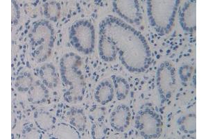 Immunohistochemistry (IHC) image for anti-Cytochrome P450, Family 24, Subfamily A, Polypeptide 1 (CYP24A1) (AA 37-250) antibody (ABIN1862404)