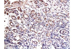 Formalin-fixed and paraffin embedded rat esophagus labeled with Anti-SOX2 Polyclonal Antibody, Unconjugated (ABIN669621) at 1:200 followed by conjugation to the secondary antibody and DAB staining (SOX2 Antikörper  (AA 227-317))